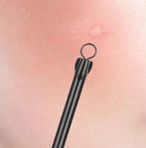ACNE NEEDLE / BLACKHEAD EXTRACTOR
